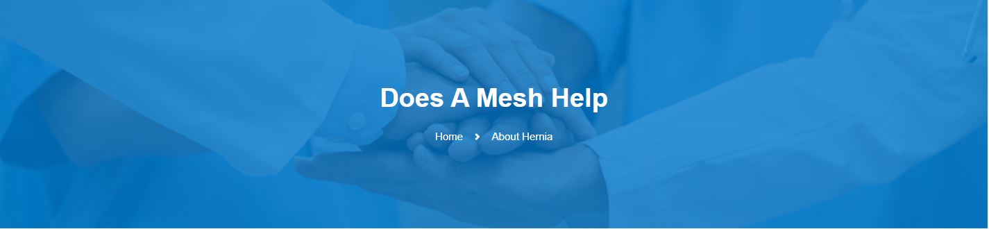 does-a-Mesh-Help